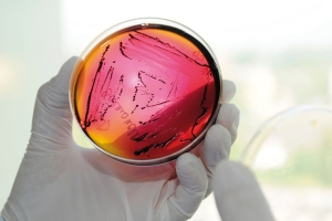Petri dish being used in research and development